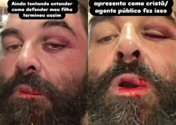 Homem agredido por guarda de folga diz que som alto de igreja afeta filho autista: 'Pedi respeito e a resposta foi violência'