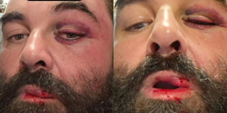 Homem agredido por guarda de folga diz que som alto de igreja afeta filho autista: 'Pedi respeito e a resposta foi violência'