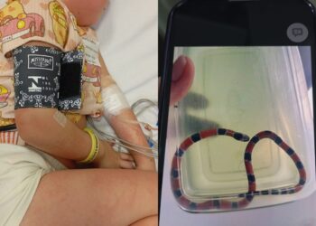 Menina de 4 anos sofre choque anafilático após irmão confundir cobra-coral com minhoca em SC