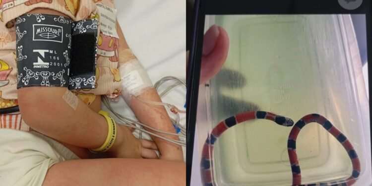 Menina de 4 anos sofre choque anafilático após irmão confundir cobra-coral com minhoca em SC