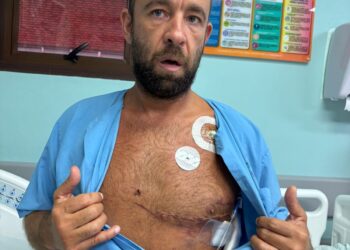 'Memória apagou’: brasileiro atingido no coração por peixe na Costa Rica recebe alta e diz não se lembrar do acidente