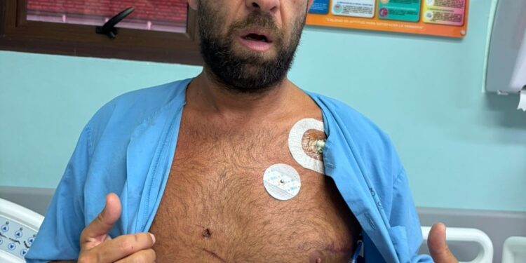 'Memória apagou’: brasileiro atingido no coração por peixe na Costa Rica recebe alta e diz não se lembrar do acidente